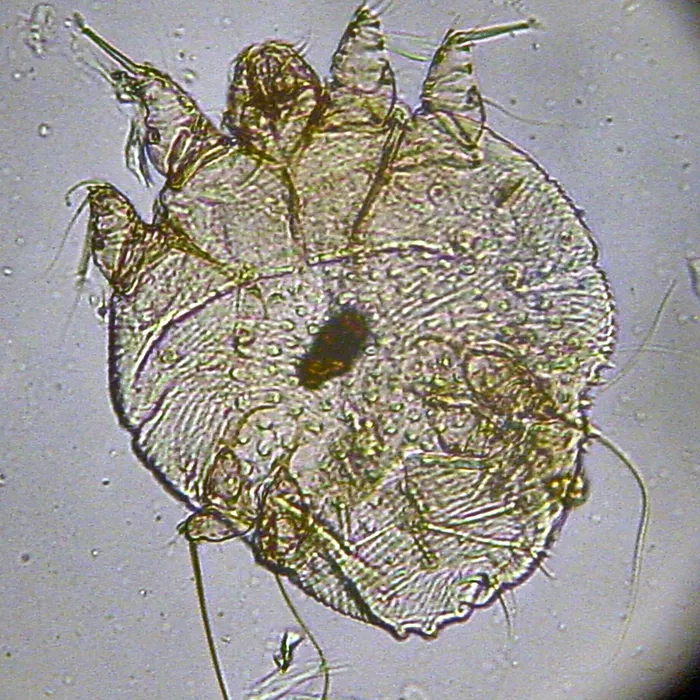 Acaro della scabbia (Sarcoptes scabiei)